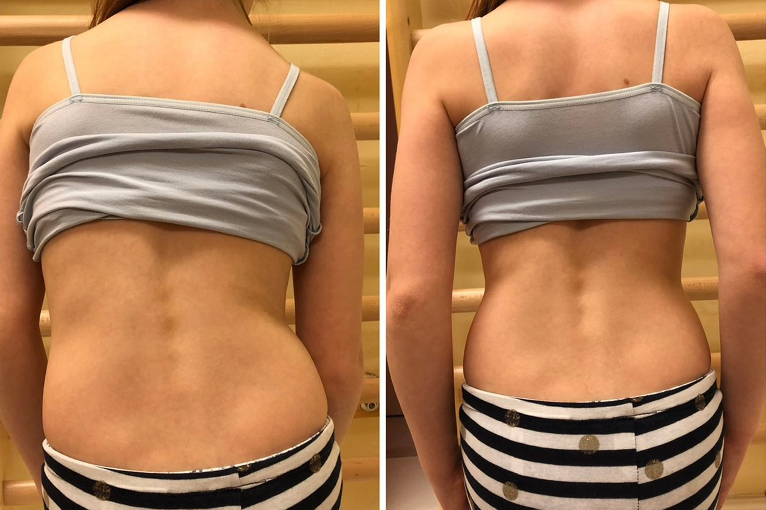 terapia20 Pfaffenrot manuális terápia